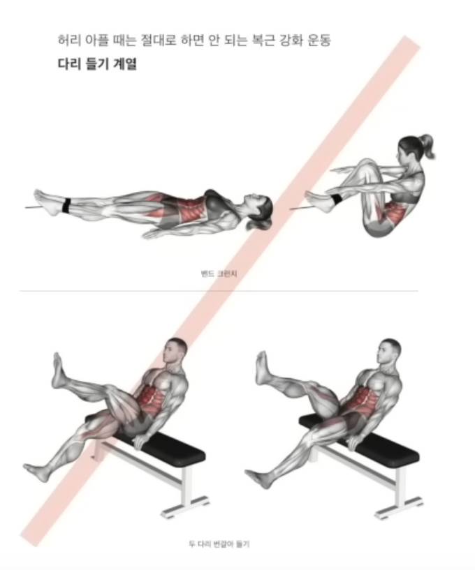 [잡담] 정선근 박사님이 말하는 '허리 안좋으면 하면안되는 운동' 목록 | 인스티즈