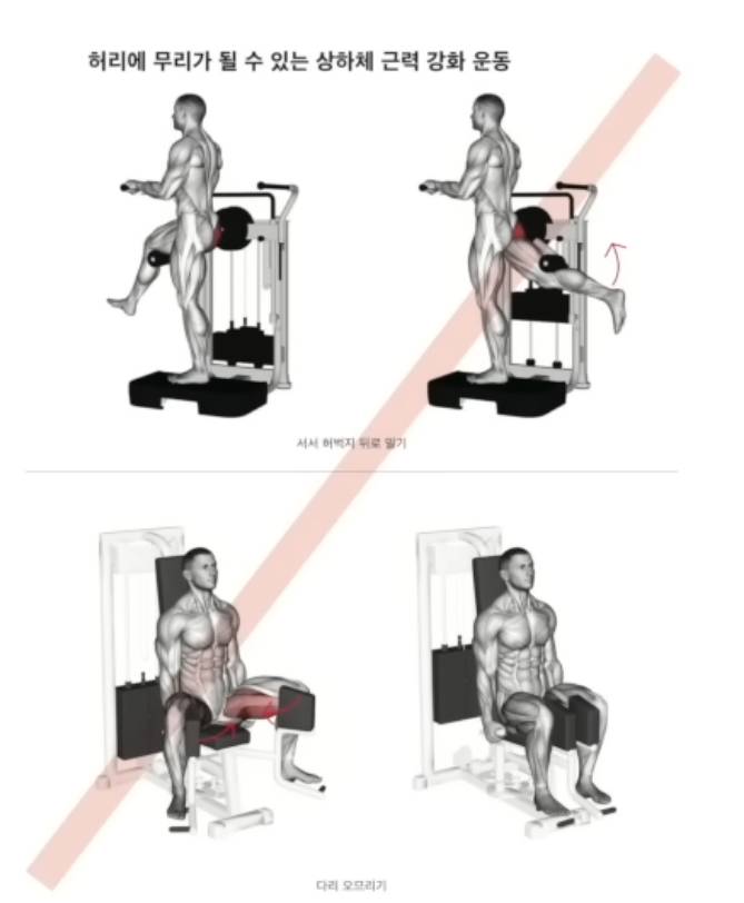 [잡담] 정선근 박사님이 말하는 '허리 안좋으면 하면안되는 운동' 목록 | 인스티즈