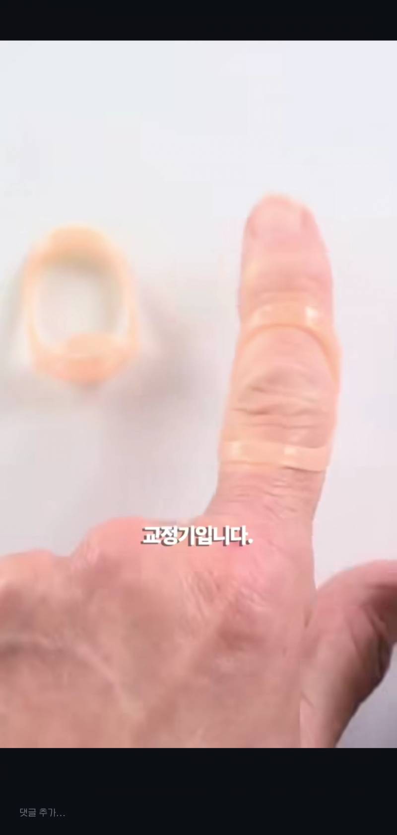 [잡담] 와 이런 손가락 가지고 있으면 교정해야 하는 거구나.. | 인스티즈