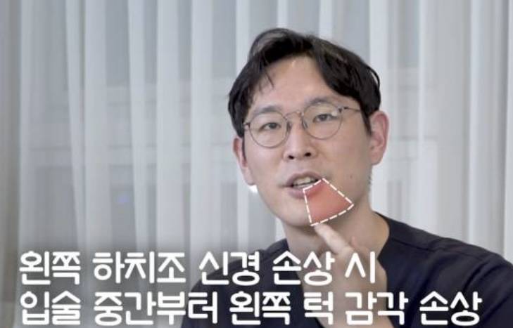 [잡담] 매복사랑니 뽑고 턱 감각이 없어 ㅠㅠ 신경 손상이야? | 인스티즈