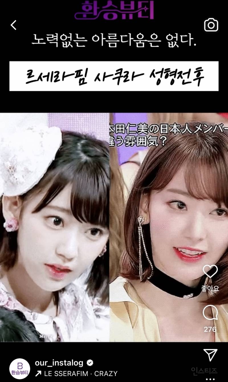 르세라핌 사쿠라 성형 전,후 | 인스티즈