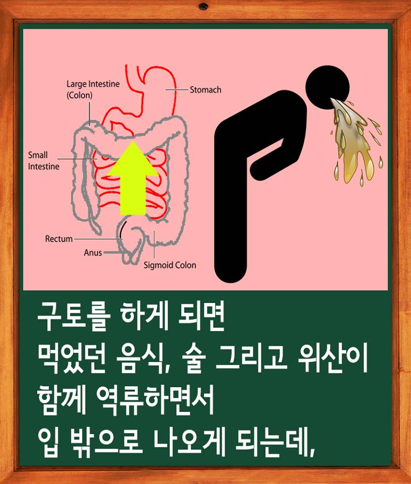 술을 많이 마시면 토하는 이유 jpg | 인스티즈