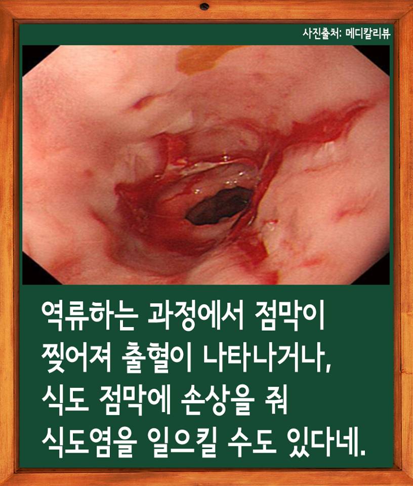 술을 많이 마시면 토하는 이유 jpg | 인스티즈