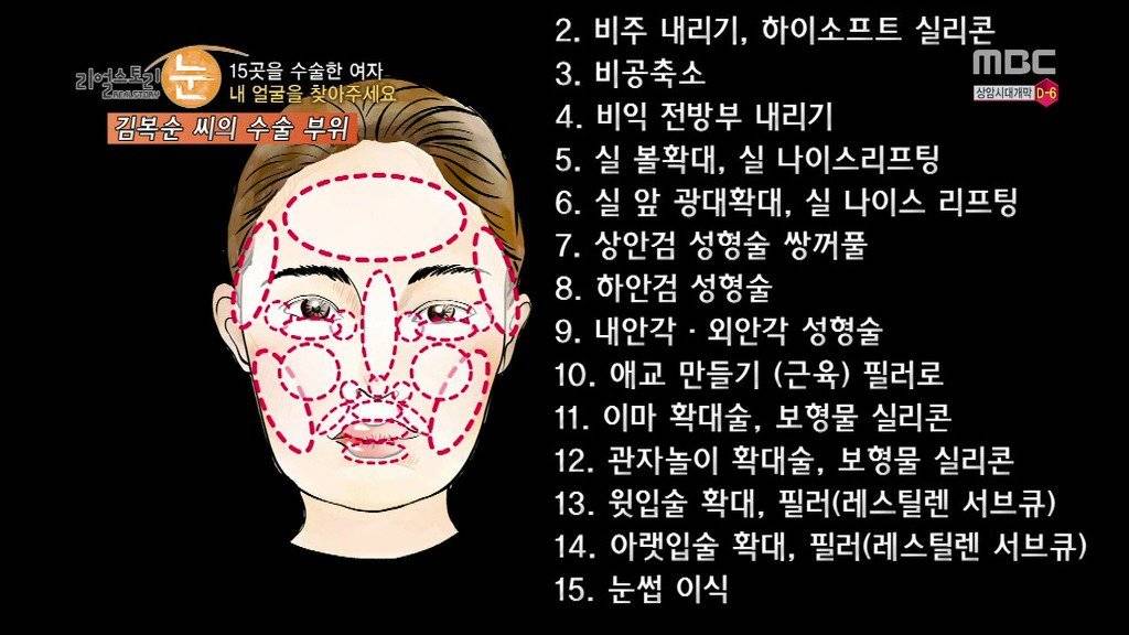 확인된 피해자만 50명이 넘는 싸이코 성형외과 의사 | 인스티즈