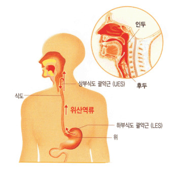 많은 사람들이 가지고 있는 습관 | 인스티즈