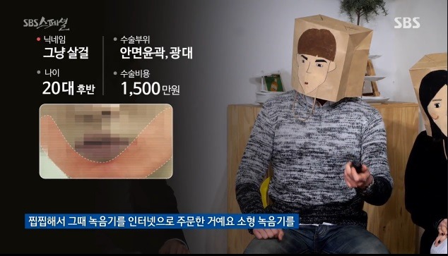 성형 수술한 남자가 녹음한 의사들 잡담 | 인스티즈