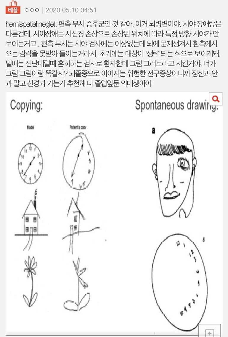 사람 눈이 한쪽만 보여 | 인스티즈