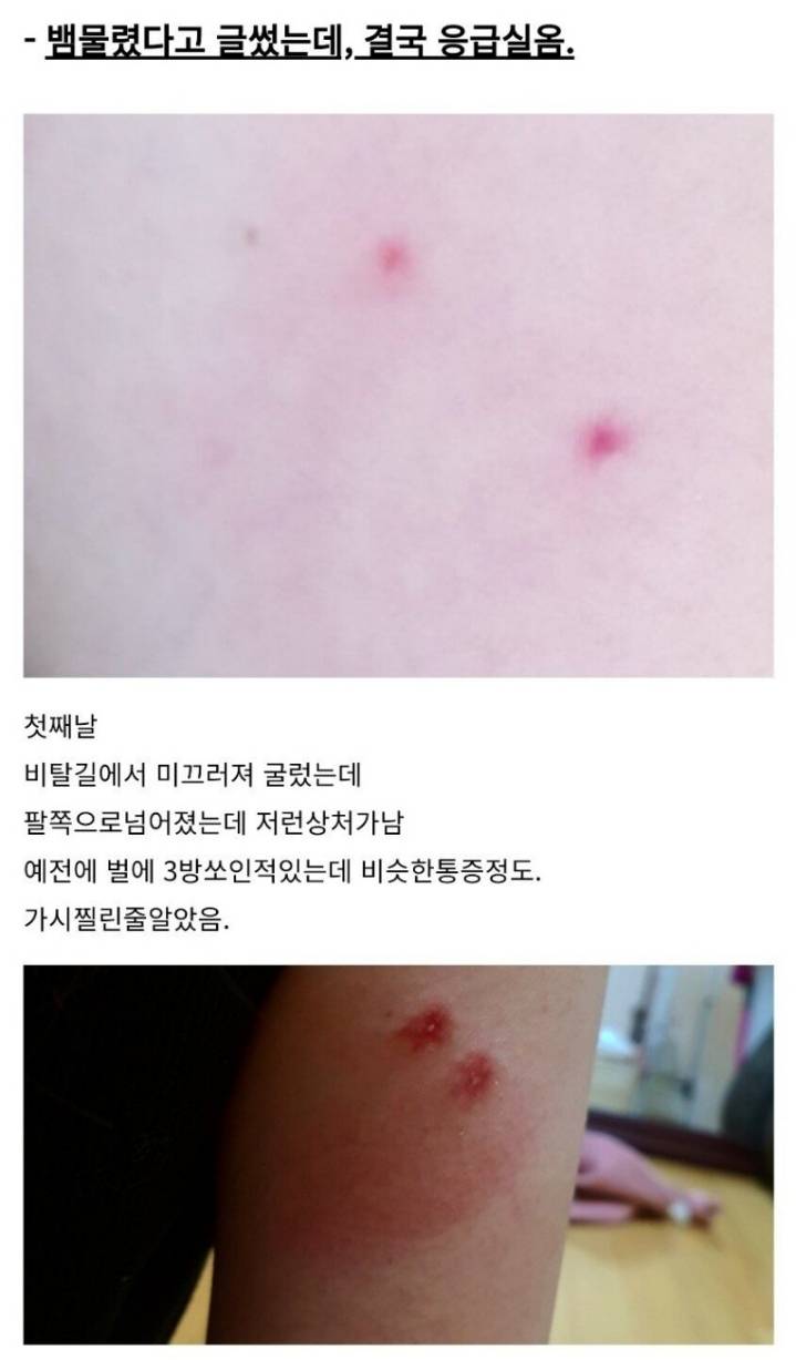 산책하다가 독사에게 물린 디시인 후기.jpg | 인스티즈