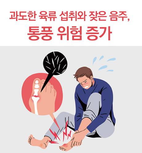 '1일1닭' ' 단백질 열풍' 폭탄 터지나 - 통풍 환자 2배로 증가 , 대안은? | 인스티즈