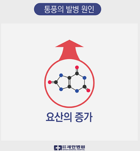 '1일1닭' ' 단백질 열풍' 폭탄 터지나 - 통풍 환자 2배로 증가 , 대안은? | 인스티즈