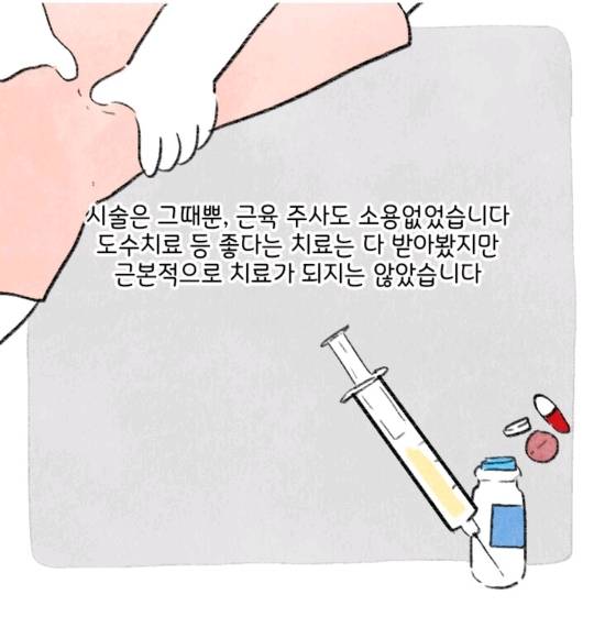 허리디스크 터진사람이 말하는 똥꼬 힘주고 걷기효과 | 인스티즈