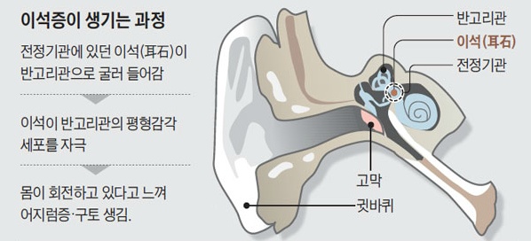 자다가 일어날때 너무 어지러워서 못일어나는 병.jpg | 인스티즈