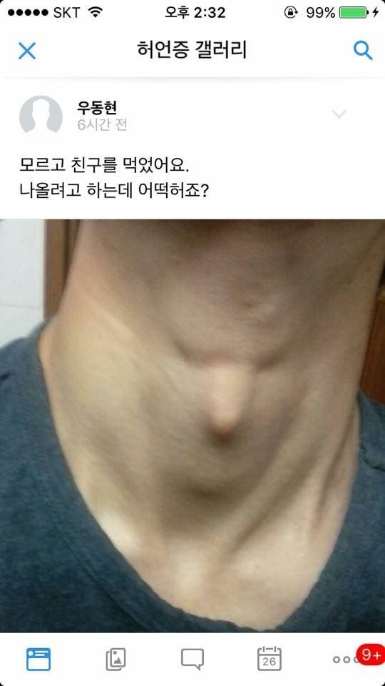 나 금수저인데...먹고 살기가 너무 힘들다... | 인스티즈