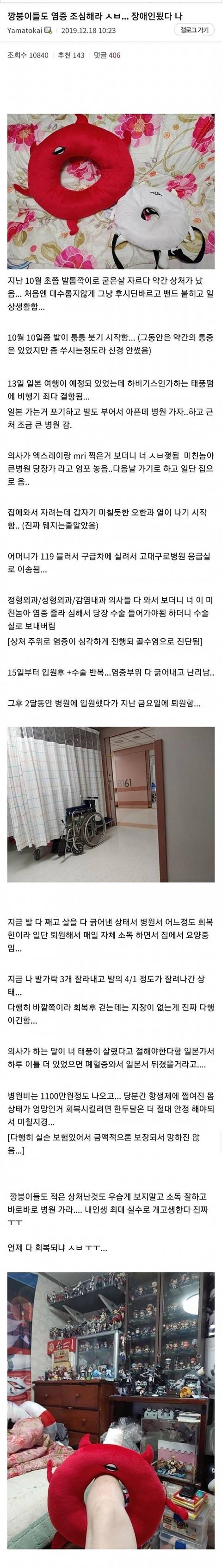 발톱깎이로 굳은살 자르다가 발가락 3개 절단한 디시인 | 인스티즈