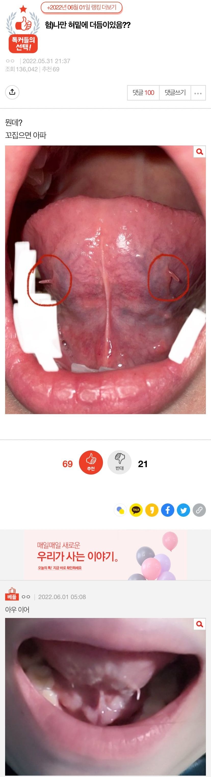 혐)나만 혀밑에 더듬이있음??