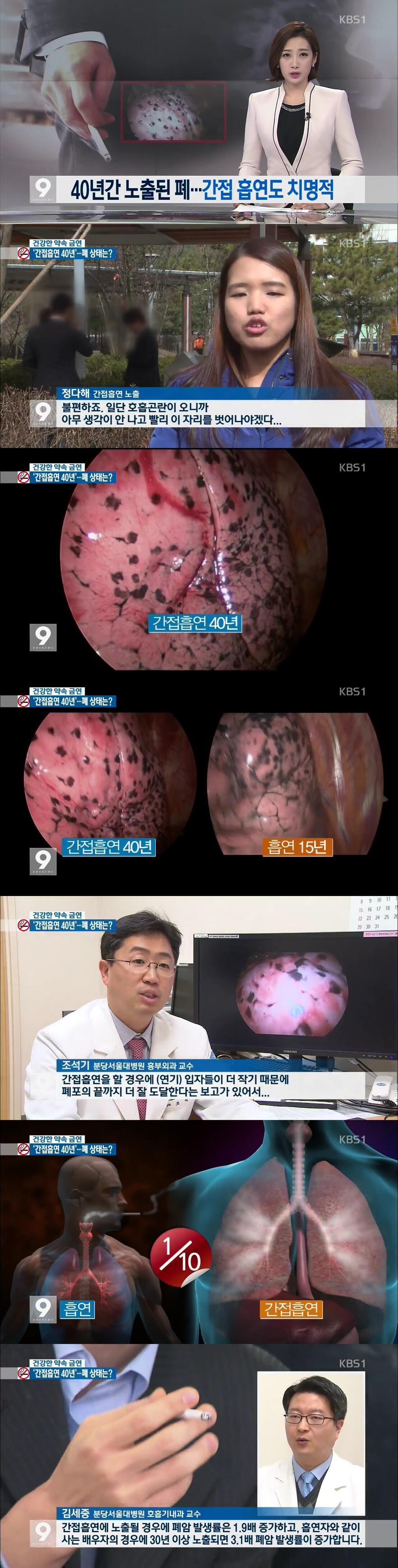 비흡연자, 간접흡연, 흡연자 폐 사진 | 인스티즈