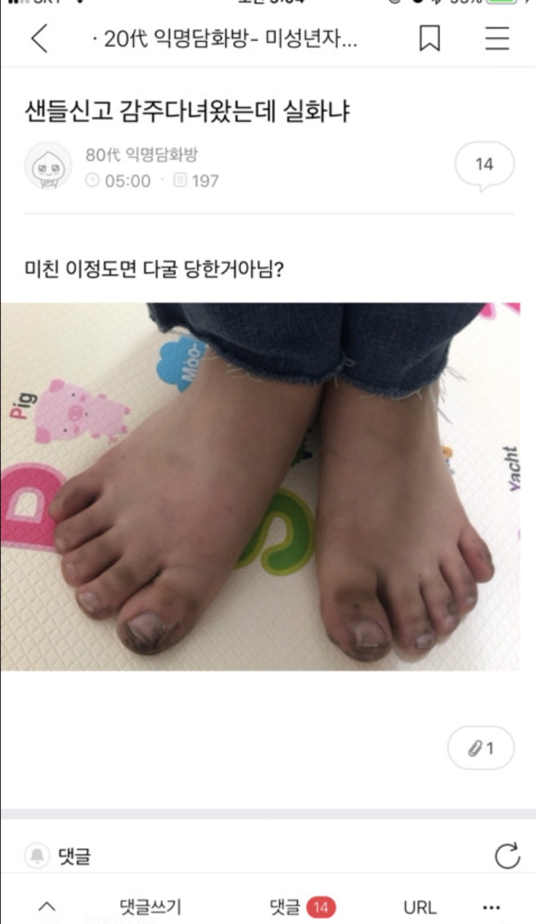 치과쌤이 나보고 엄살 하나도 없대 아픈거 잘 참는대 | 인스티즈