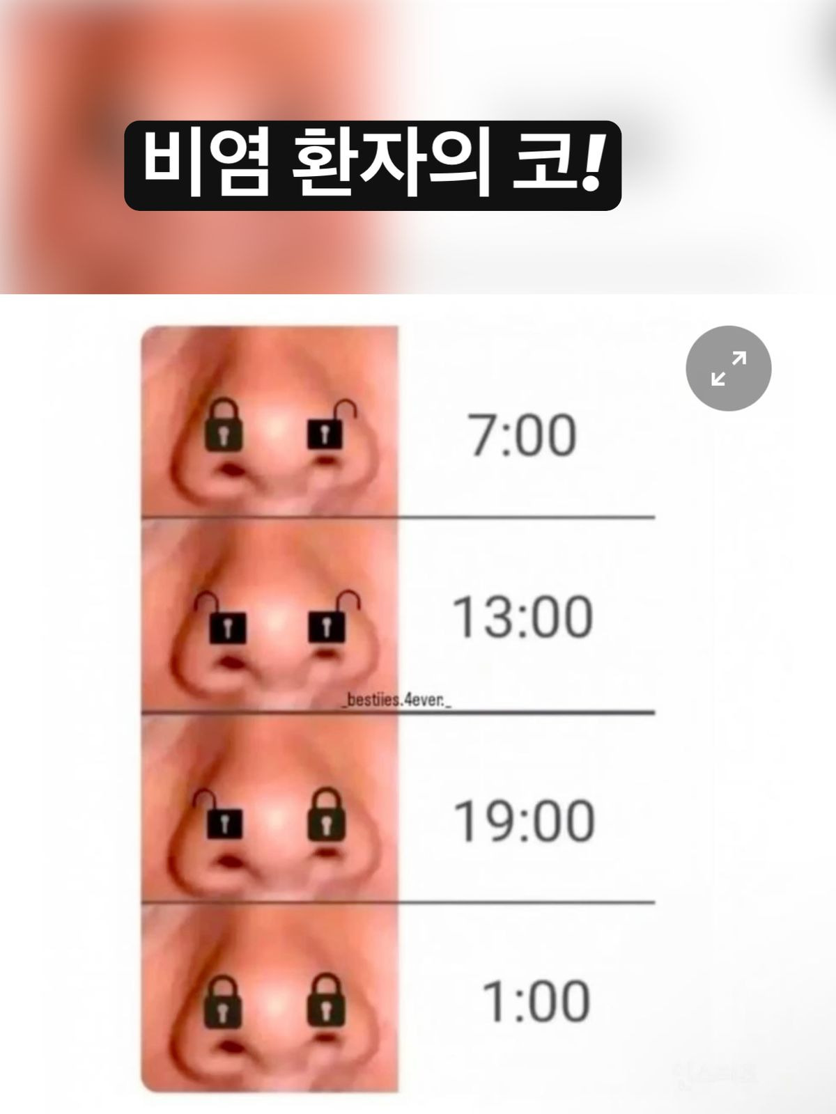  비염 환자의 코.jpg