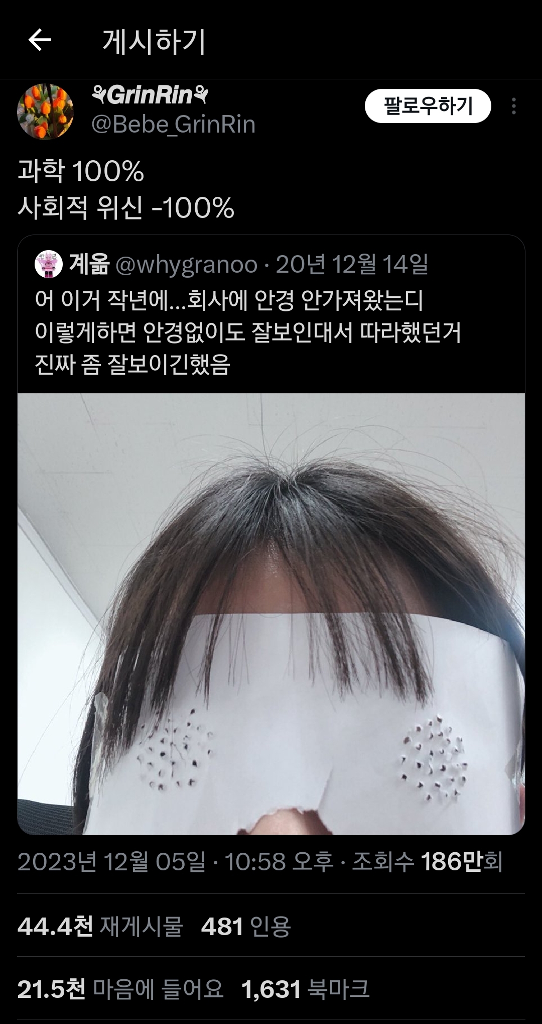 회사에 안경 안가져왔는디 이렇게하면 안경없이도 잘보인대 | 인스티즈